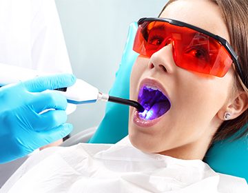 Лазерне відбілювання зубів